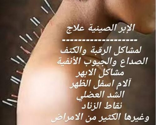 حجامة وتدليك رياضي وابر صينية