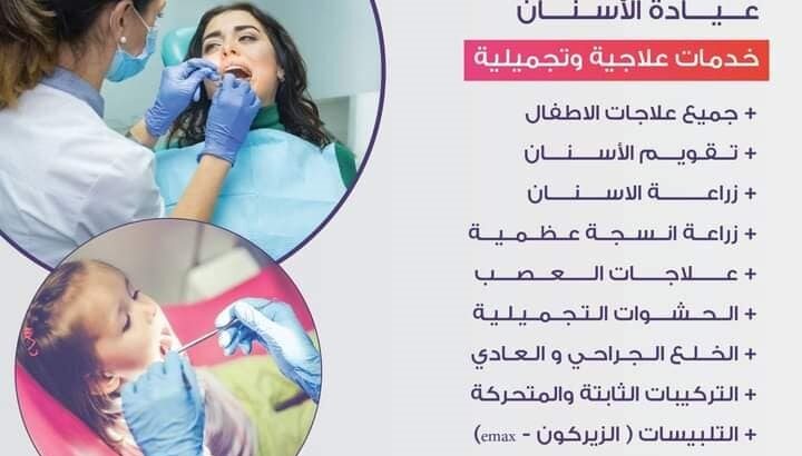 زراعة الاسنان
